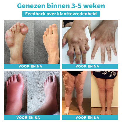 Er zijn maar nog 5 flessen over! 🌈Wij bieden nu een extra 30% korting! Aanbevolen door experts, zijn 4-5 flessen genoeg om uw gezondheid volledig te herstellen, zonder hoge kosten te maken. Als u deze kans mist, moet u wellicht tot volgend jaar wachten.